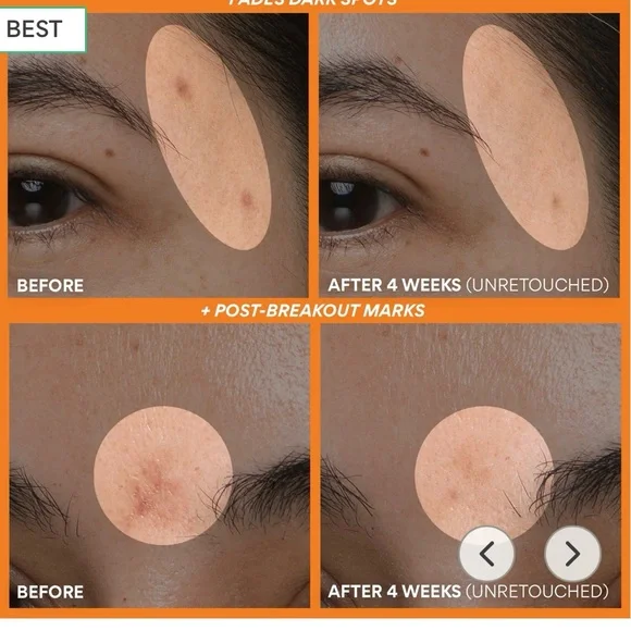 Innisfree Green Tea Enzyme Vitamin C Brightening Serum - Picture 4 of 12